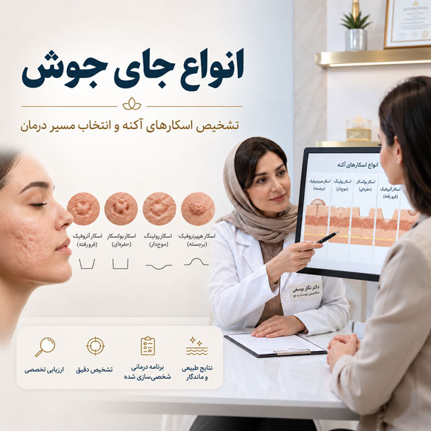 بررسی انواع جای جوش و اسکار آکنه توسط متخصص پوست برای انتخاب مسیر درمان