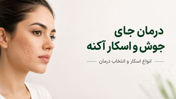 درمان جای جوش و اسکار آکنه