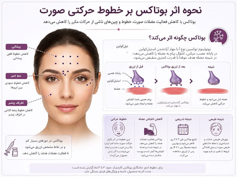 اینفوگرافیک نحوه اثر بوتاکس بر خطوط حرکتی صورت با کاهش فعالیت عضلات