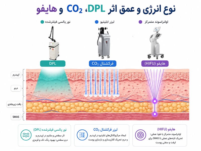 عمق اثر DPL، لیزر CO2 فرکشنال، RF میکرونیدلینگ و هایفو در لایه‌های پوست
