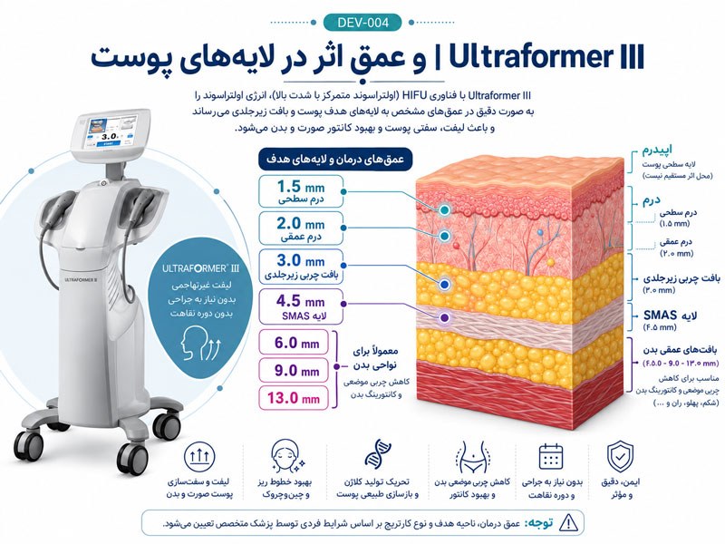 عمق اثر کارتریج‌های Ultraformer III در لایه‌های پوست، چربی زیرجلدی و SMAS از 1.5 تا 13 میلی‌متر