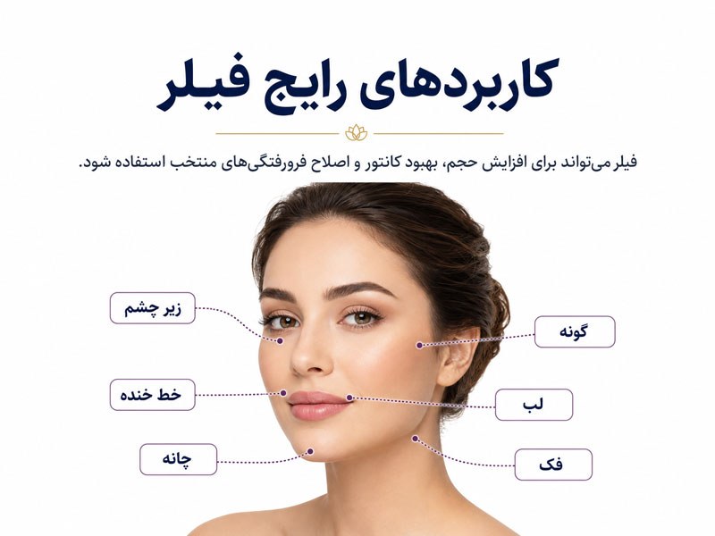 ناحیههای رایج تزریق فیلر در صورت و کاربردهای هر ناحیه