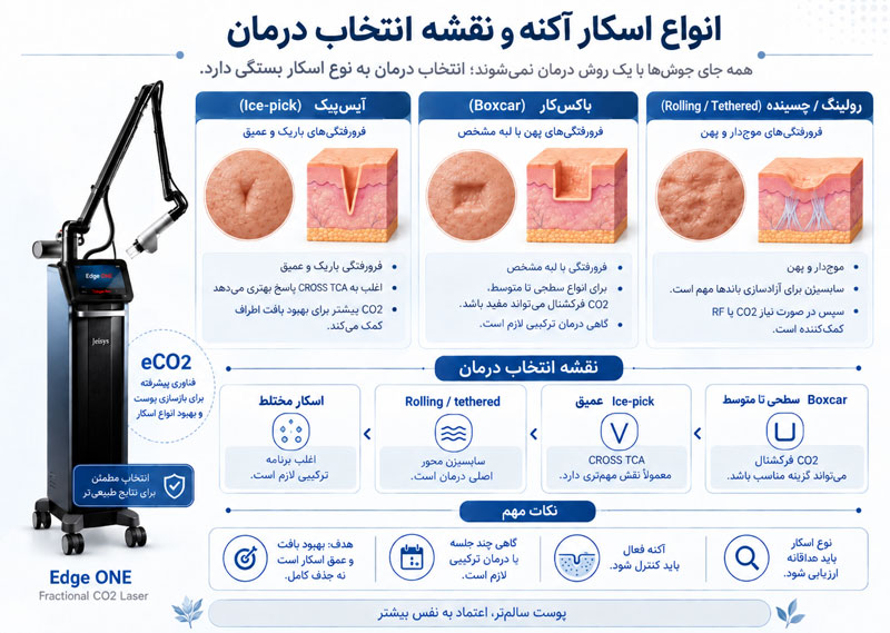 انواع اسکار آکنه و انتخاب درمان