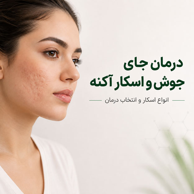 درمان جای جوش و اسکار آکنه