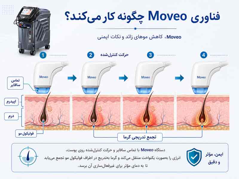 نحوه عملکرد فناوری Moveo در دستگاه Motus AX و گرمایش تدریجی فولیکول مو